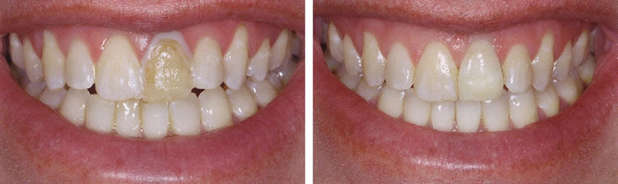 Dentist Princeton, NJ 08540 - Payam Hanian, DMD - Smile ...