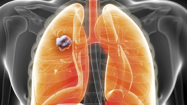 cancer donations