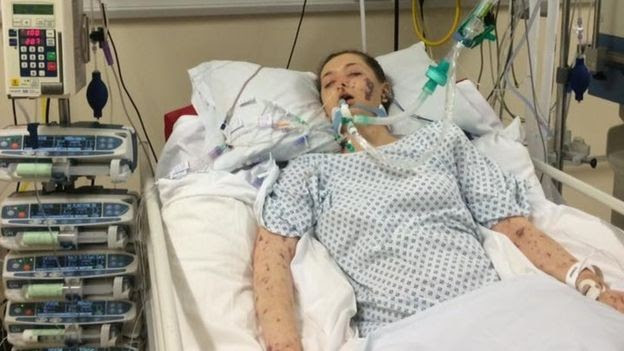Charlene diz se sentir sortuda por ter sobrevivido à doença (Foto: Charlene Colechin)