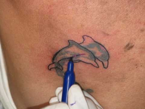Polynesian Tonga tattoo fix - Amazing repair of old tattoo by local artist