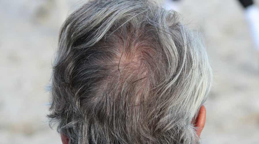 Graue Haare Beim Mann Kein Grund Zur Panik Maennerseite Ch
