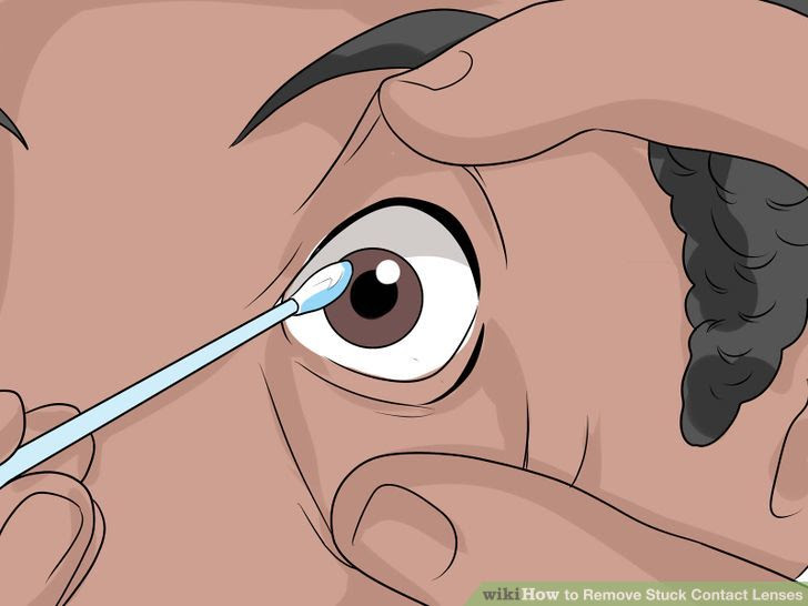 Remove Stuck Contact Lenses Step 7 Version 3.jpg