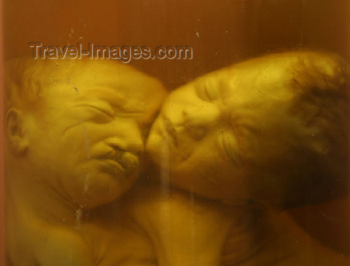 Vietnam Ho Chi Minh City Saigon Deformed Stillborn Children The Result Of Agent Orange War Remnants Museum Photo By Rod Eime Travel Images Com