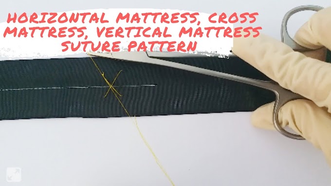 Horizontal Mattress / ResidentNet/Clinical/mattress : Running horizontal mattress suture technique.