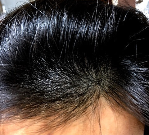 育毛剤で効果のなかった人へ 髪が変わった 育毛剤とは Life Channel