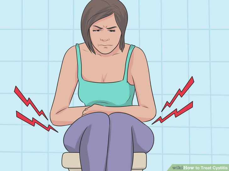 Treat Cystitis Step 1 Version 2.jpg