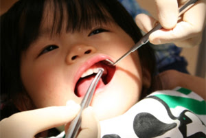 横浜 小児歯科 フッ素塗布 あおばデンタルクリニック 横浜市青葉区
