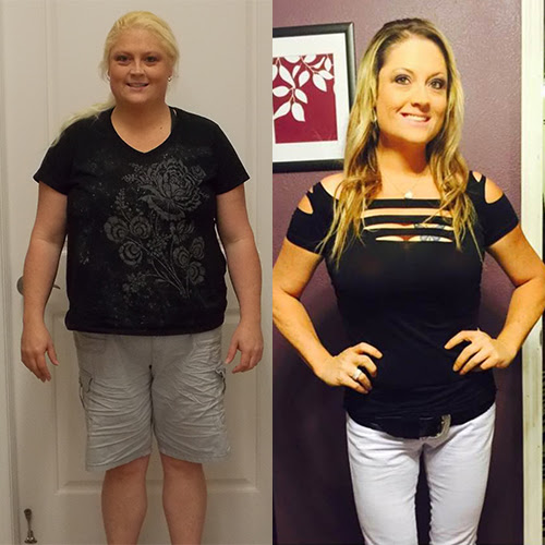 Gastric Sleeve Success Stories Freedom From Obesity