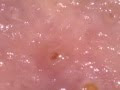 25 Elegant Mites Under Your Skin