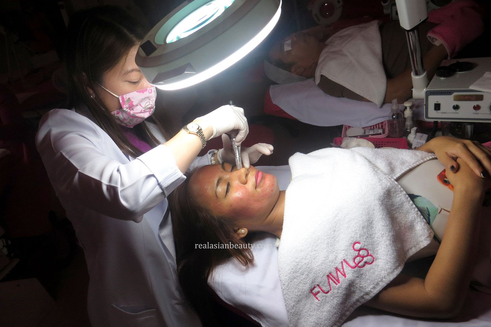 Skin Update : 4th Session of FNT at Flawless (Fractional Needling Therapy)