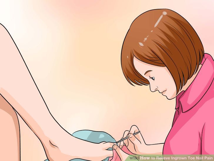 Relieve Ingrown Toe Nail Pain Step 31 Version 2.jpg