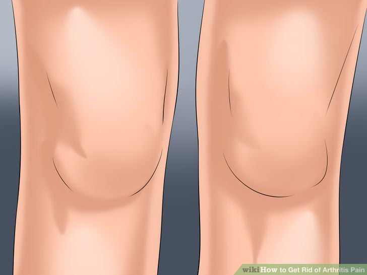Get Rid of Arthritis Pain Step 9 Version 2.jpg