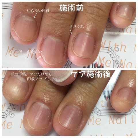 With Me Nailの顧客様からの招待状 香川県高松市の 爪を育てるネイルサロン With Me Nail 口コミで40代50代以降の女性に人気の秘密は 爪の形は３ヶ月で自信に変えられる から