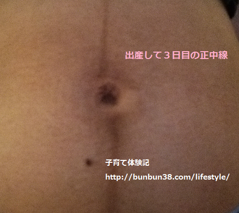 産後 脇の黒ずみ