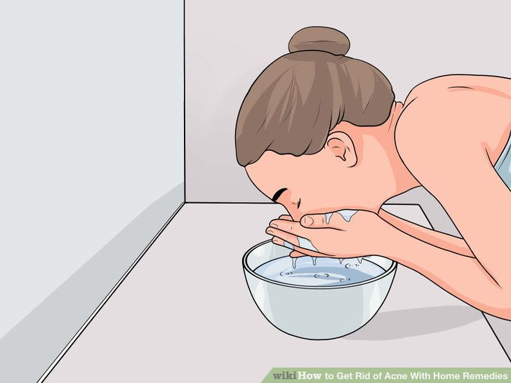 Get Rid of Acne With Home Remedies Step 2.jpg