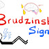 Brudzinski Sign In Meningitis : Sep 19, 2018 · brudzinski’s sign: