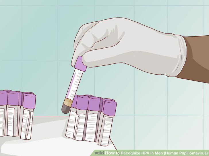 Recognize HPV in Men (Human Papillomavirus) Step 6 Version 2.jpg