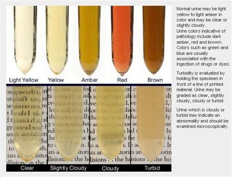  cloudy urine