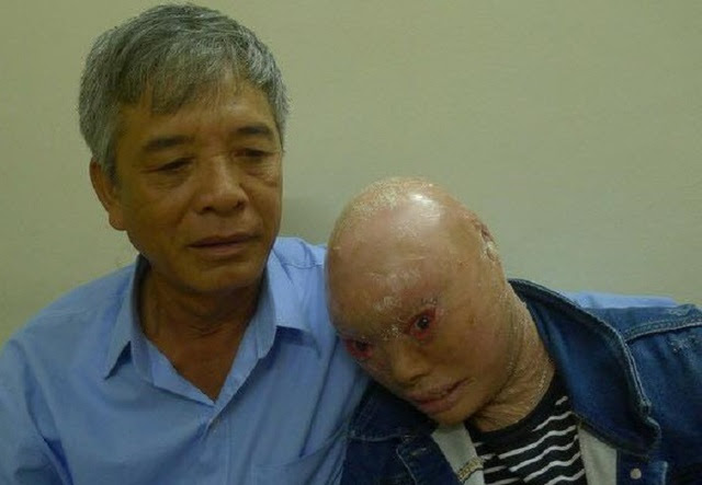  Ông Lê Ngọc Niềm và con gái Lê Thị Hằng. Ảnh: Nguyễn Bảo Ngọc 