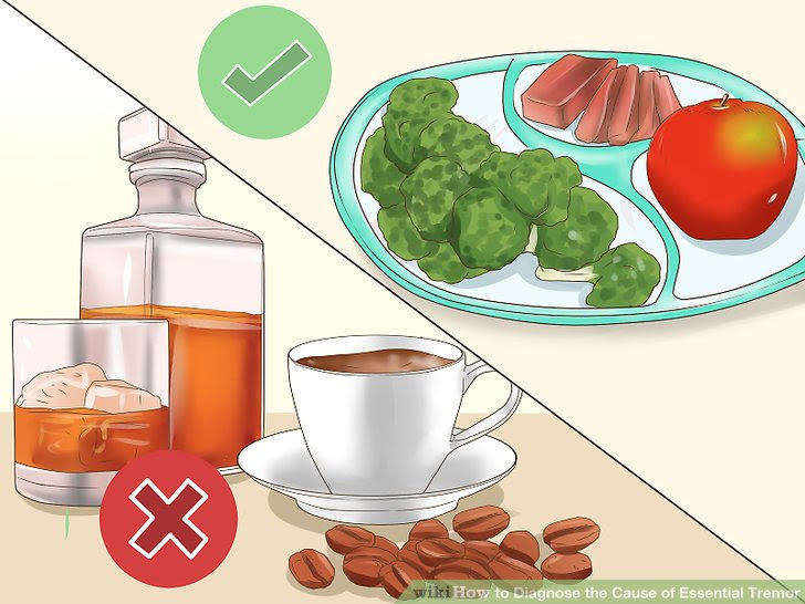 Diagnose the Cause of Essential Tremor Step 13.jpg