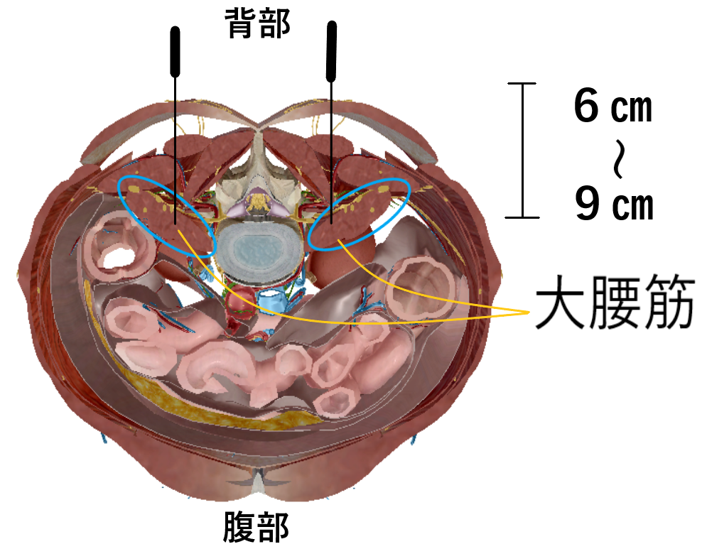 大腰筋刺鍼について 北京堂鍼灸首里 いじゅ治療院