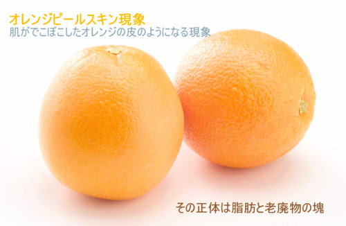 セルライト除去マッサージ エステ 潰すと痛い やり方とローラー 動画 情報あらかると