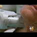Lm Thermage u Tt Download Clip mp3 and Mp4