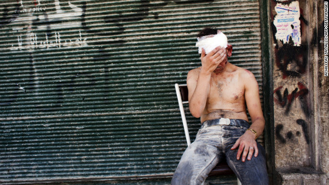 A Syrian man wounded by shelling sits on a chair outside a closed shop in Aleppo on September 4, 2012.