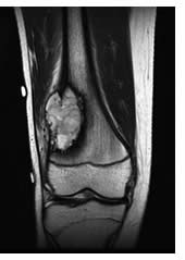 tratamiento de cancer para perros
