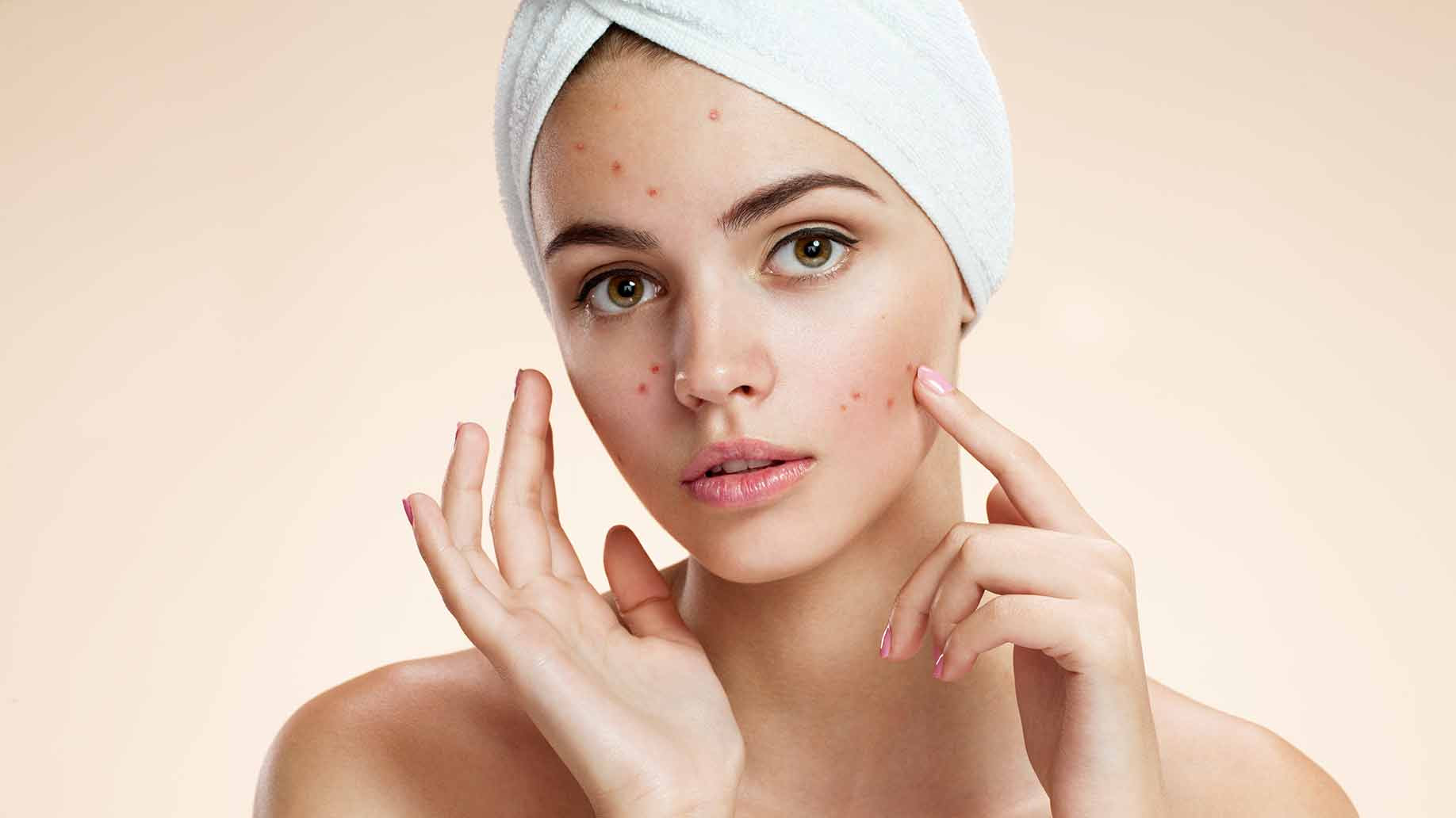 Simple oatmeal household recipe treat Acne