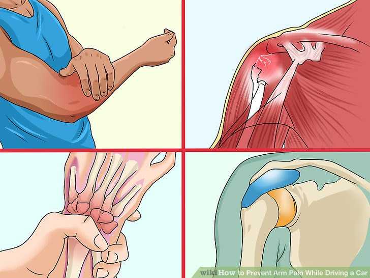 Prevent Arm Pain While Driving a Car Step 12.jpg