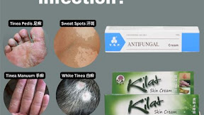 Eliminate Fungal Infections with High-Quality Anti Fungal Cream in Singapore