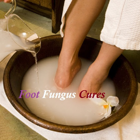 Foot Fungus Cures Foot Fungus Cures