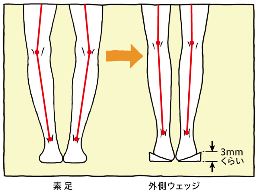 靴の減り方 でわかる あなたの 足のトラブル 解決編 足のお悩み百科