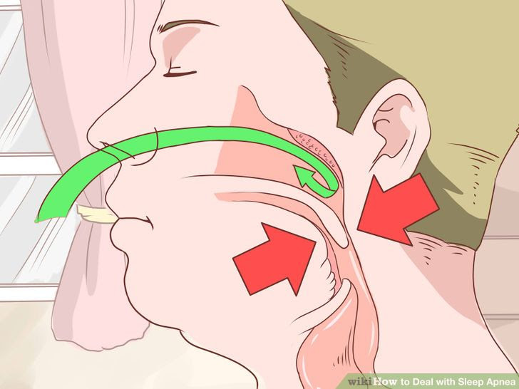 Deal with Sleep Apnea Step 1 Version 2.jpg