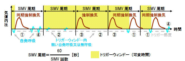 Simv 同期式間欠的強制換気