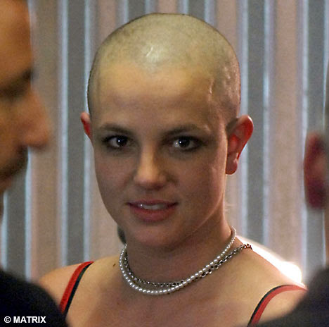  bald