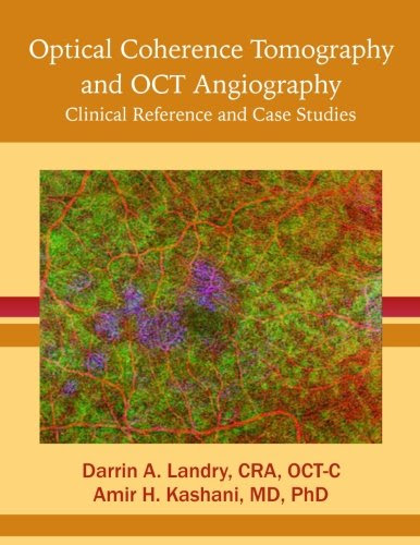 Optical Coherence Tomography  and OCT Angiography: Clinical Reference and Case Studies, by O, Darrin A. Landry CRA, Amir Kashani PhD MD