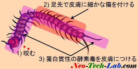 ムカデに刺されたら４３ 以上の熱めのシャワーで刺咬傷をよく温めてシャンプー洗浄を 痛み抑制 腫れ 痒み防止 Neotechlab