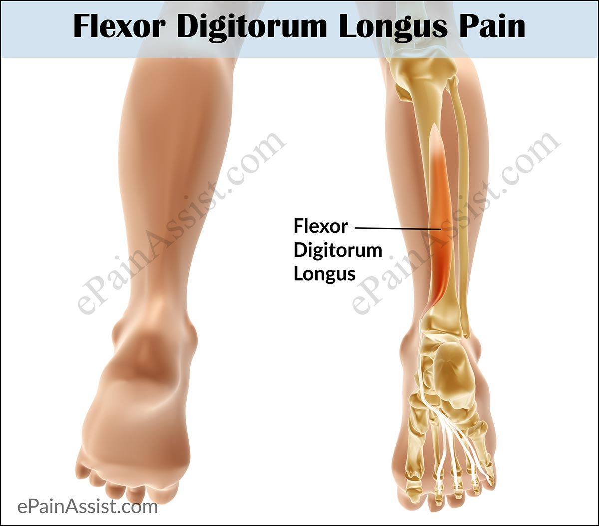 Flexor Digitorum Longus Pain|Symptoms|Causes|Treatment