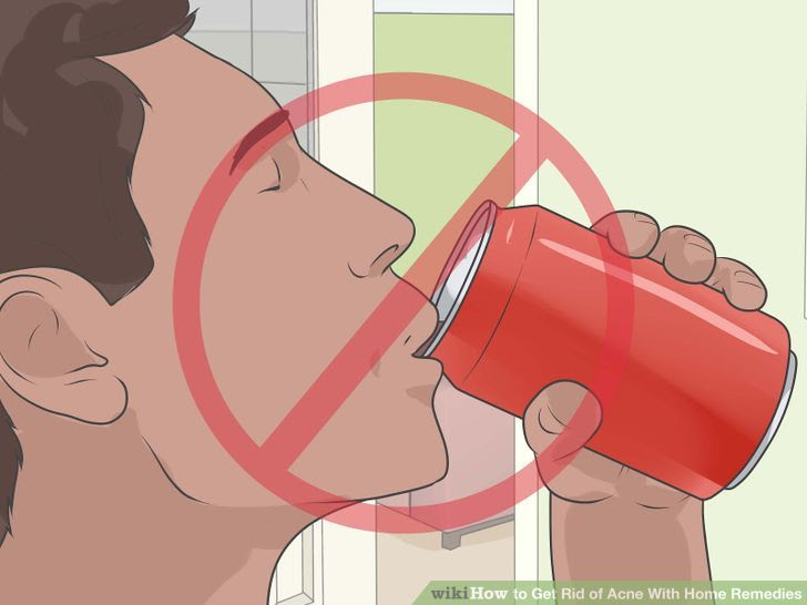 Get Rid of Acne With Home Remedies Step 24.jpg