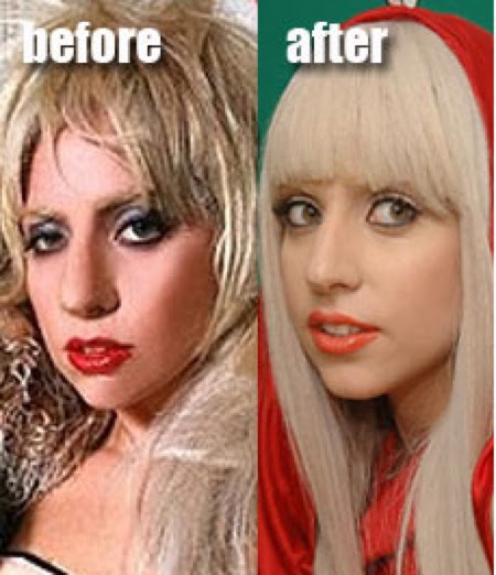 lady gaga horns surgery. DID LADY GAGA HAVE PLASTIC