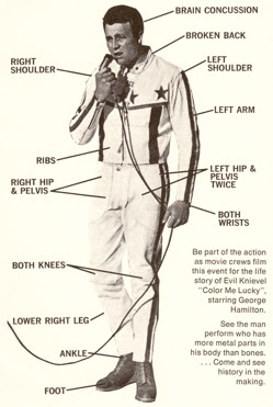 Steve Mandich Knievel Injuries