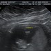 BURT_ADRIENNE_4