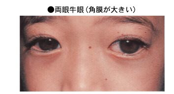 病気を治す食べ物 家庭の医学大辞典 子供の病気 大人の病気
