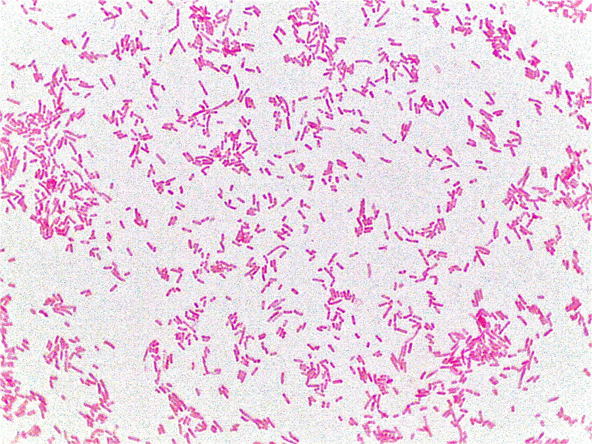 Escherichia coli colony morphology and microscopic