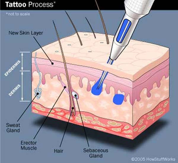  unsterile tattooing needles), 