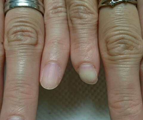 人工爪でキレイな形に Tetote Nail