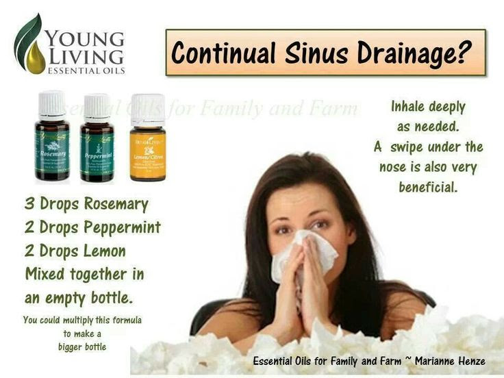 nasal bleeding sinusitis