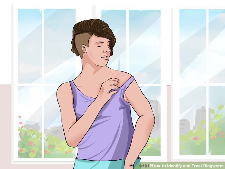 Identify and Treat Ringworm Step 5 Version 2.jpg